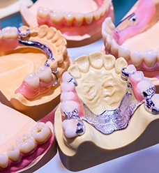 partial dentures placed on molds of mouths