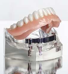 Model hybrid denture