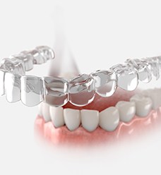 Invisalign® aligner in Jacksonville