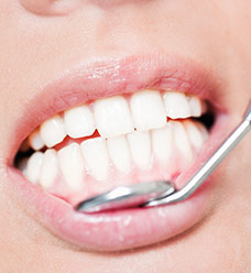 Close up of dental mirror checking gums