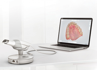 3d scanner