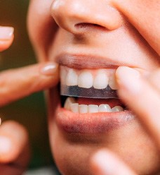 Woman using teeth whitening strips