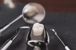 extracted tooth