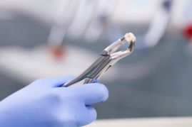 Dentist holding up an extracted tooth