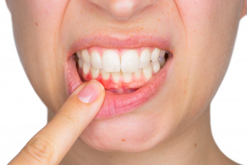 a person touching their red gums that are infected with bacteria and causing gum disease