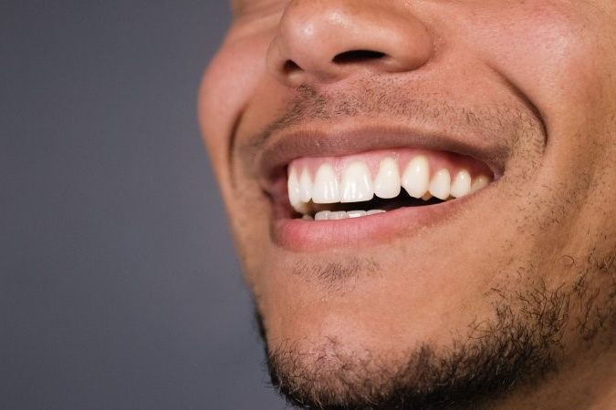 closeup of smile after healing from gum graft 