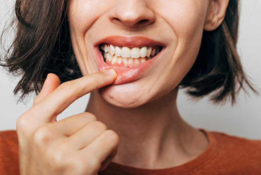 Woman showing gums