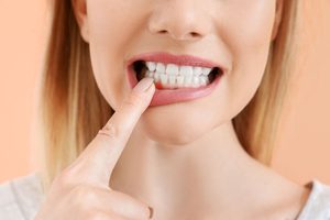 Nose-to-neck view of blond woman pushing down lower lip with pointer to show darkened gums